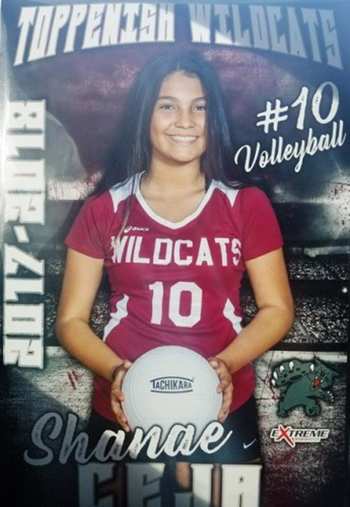 Shanae Ceja, 14, of Toppenish, is back playing sports after she successfully underwent the innovative Ozaki procedure for a heart condition at Seattle Children’s Hospital.
