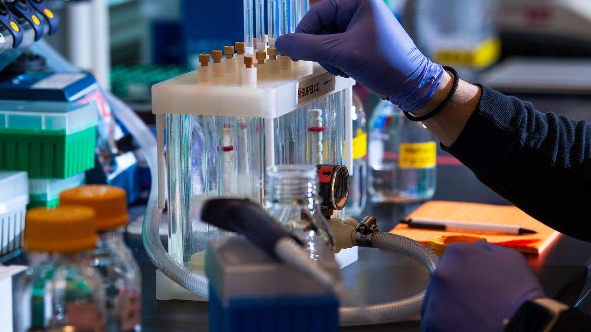 Scientists at PNNL are studying human brain tissue samples, looking for molecular-level patterns that may help them understand what causes the progression of dementia in Alzheimer’s patients.