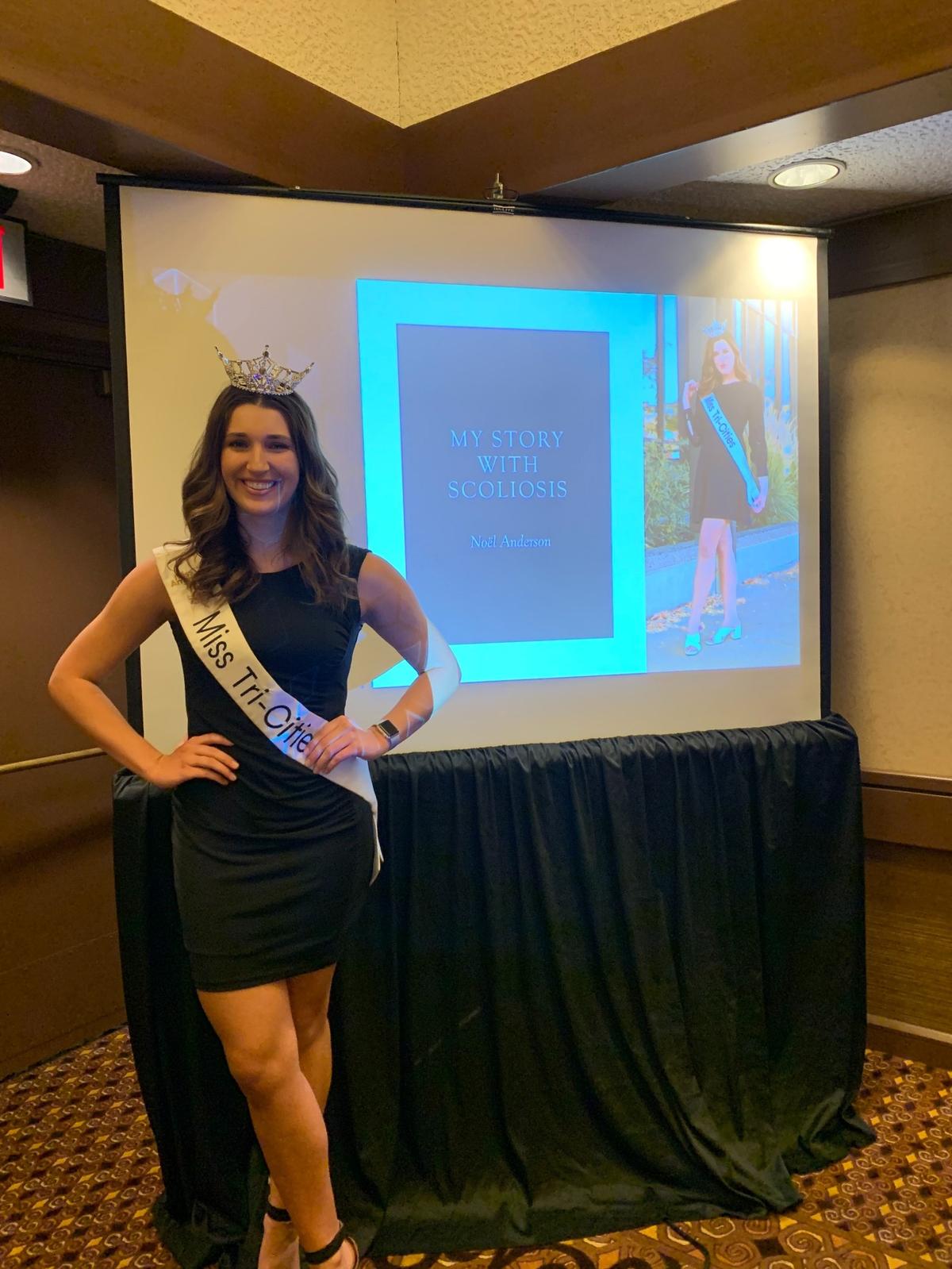 Miss Tri-Cities winner Noël Anderson speaks about her experience with scoliosis