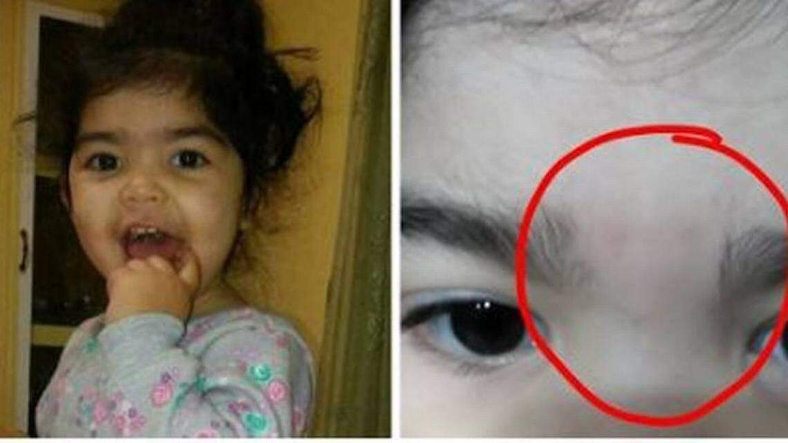 A Tri-Cities mom posted this photo of what her daughter looked like before and after she got her daughter back from daycare. She is accusing the daycare of waxing her daughter’s eyebrows.