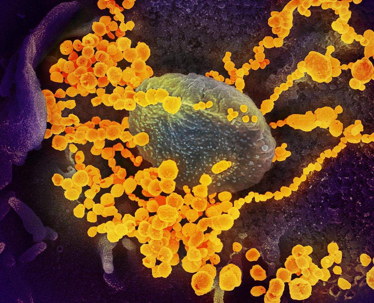 An image from a scanning electronic microscope shows the new coronavirus, the round gold objects, emerging from the surface of cells at the Rocky Mountain Laboratories in Hamilton, Mont. The lab has done preclinical research on using the antiviral drug remdesivir to treat COVID-19.