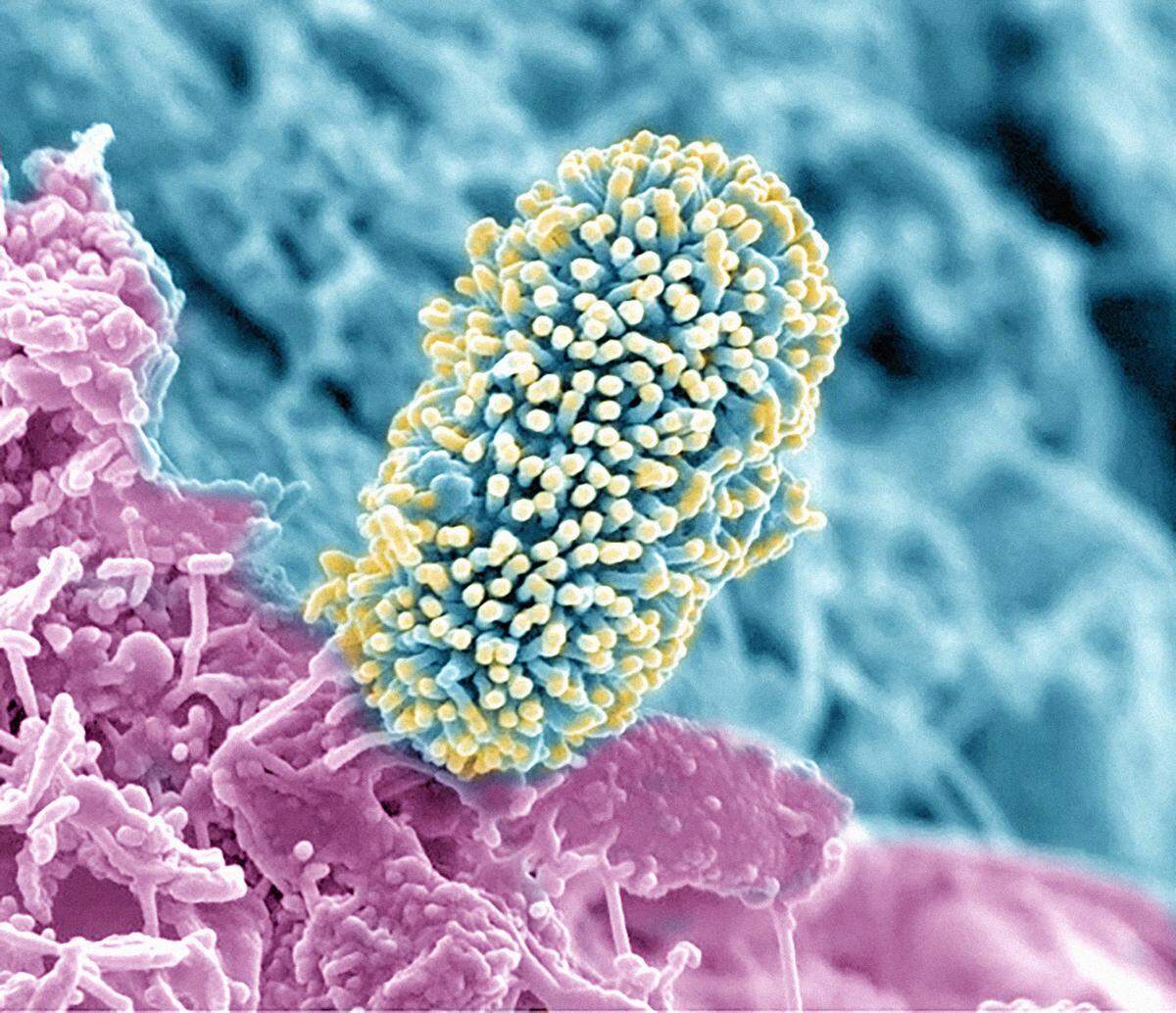 Microbes such as this one, shown on the root surface of the plant Arabidopsis, play a crucial role in soil.