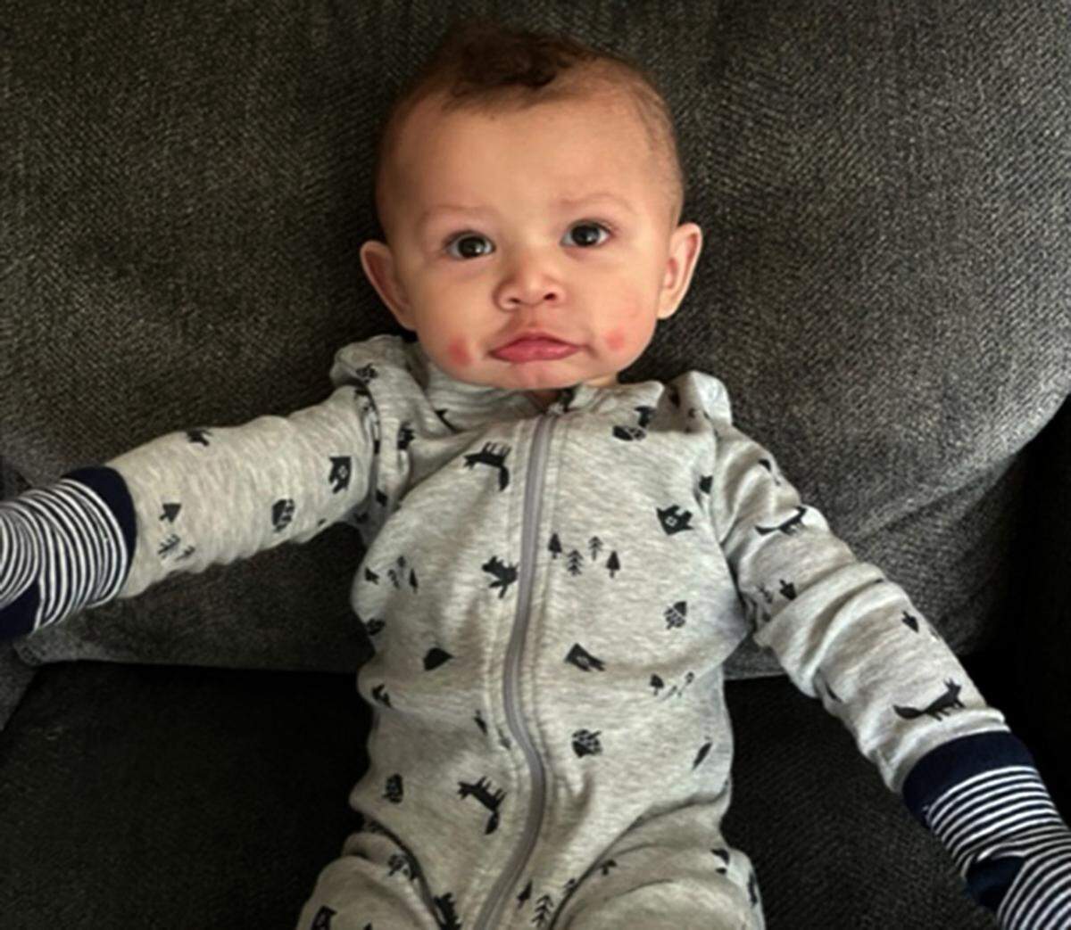 The shortage of baby formula has forced one Kennewick mother to use a substitute brand that causes her 6-month-old baby, Oakland Sans Souci, to break out with eczema. His mother, Jessica, says she has to put socks on his hands to keep him from scratching.