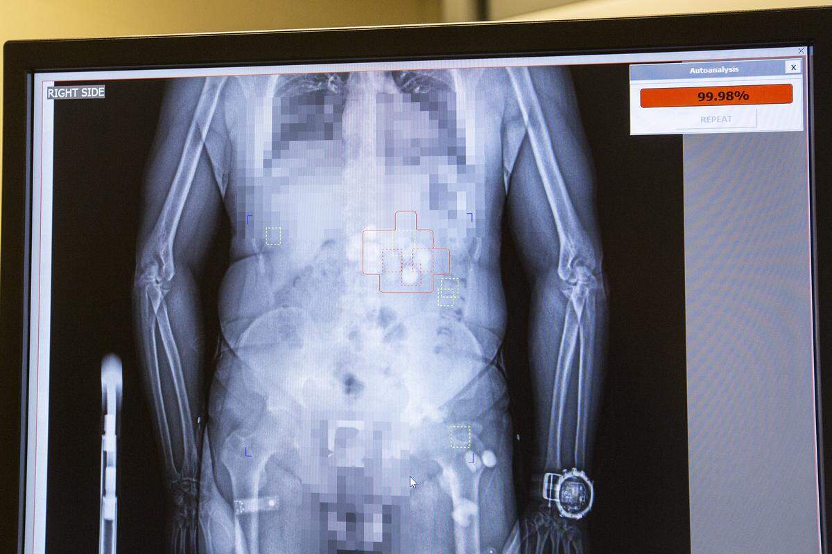 A close up view of a scan. The red indicates potential contraband.