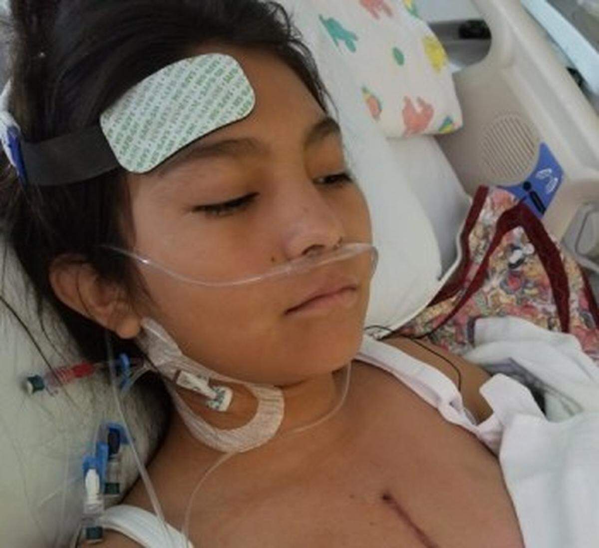 Shanae Ceja, 14, of Toppenish, at Seattle Children’s Hospital, where she underwent the innovative Ozaki procedure for a heart condition.