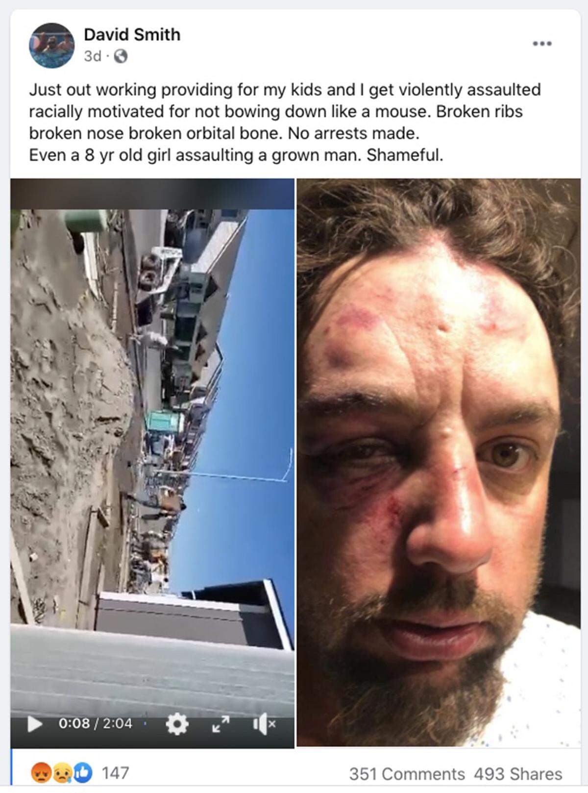 Construction worker David Smith posted a photo and video on his Facebook page of an altercation in the area of Remington Drive and Chapel Hill Boulevard the Pasco Police Department is investigating.