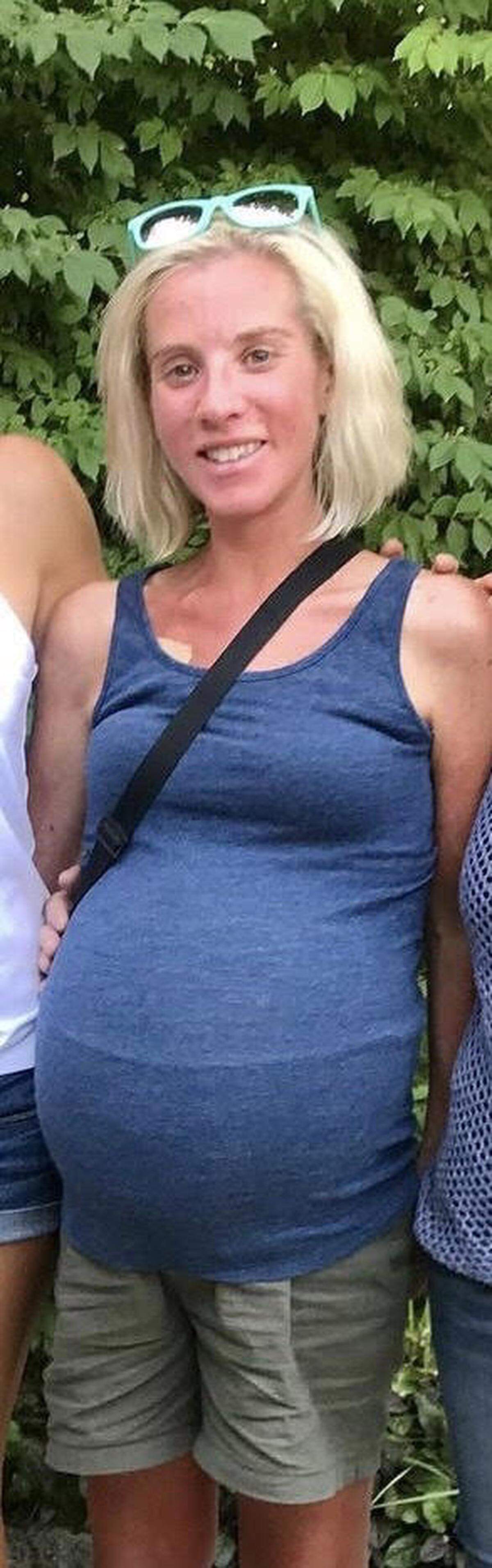 Lindsey Decker is pictured four days before her lung transplant. She started retaining fluid in January, which made her legs and stomach swell.