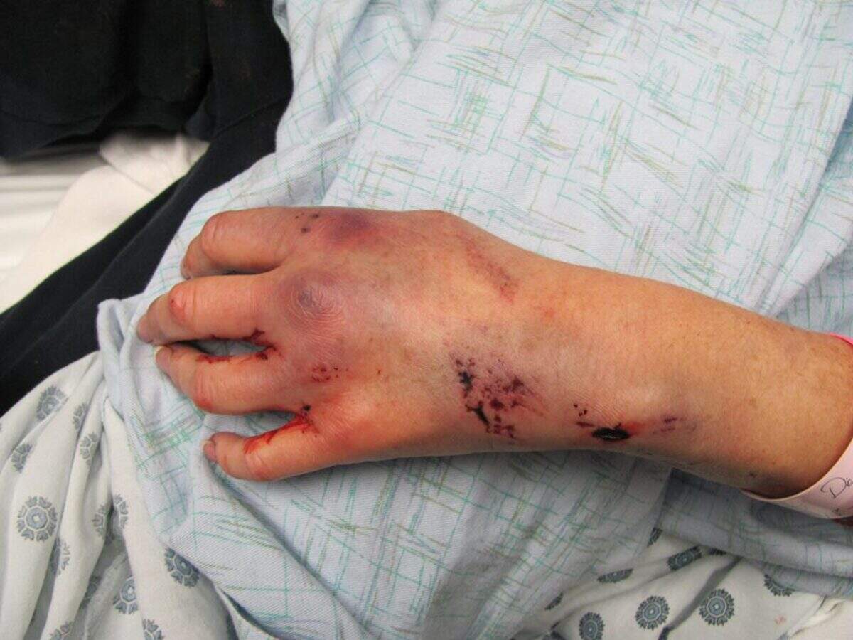 Dana Widrig was left with 43 staples in her head and crushed hands, wrists and arms after she was violently beaten and raped inside her south Richland apartment in December 2009.