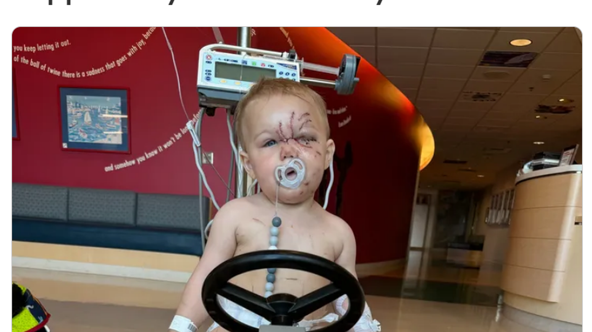 A GoFundMe campaign has been started for a Pasco toddler who was attacked by his family’s dog.