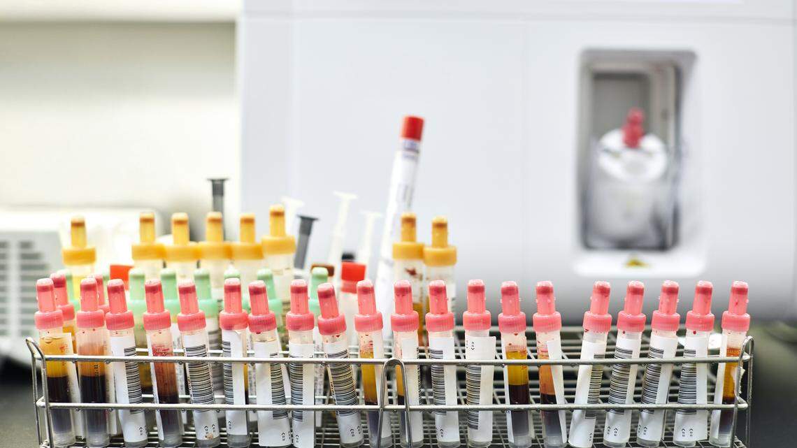 Update: Eastern WA urgent care clinic to pay $2.8M over billing fraud claims