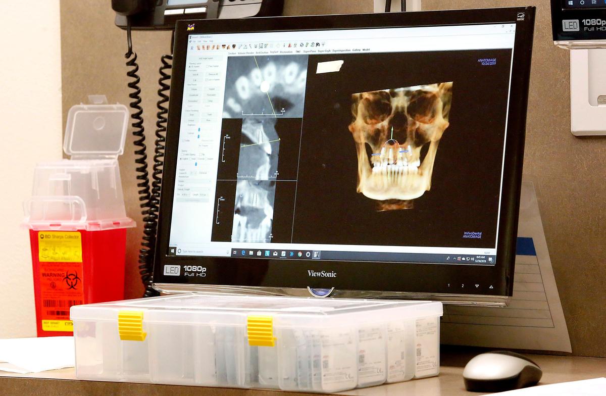 An X-ray in the surgery room at Columbia Basin Oral & Maxillofacial Surgeons in Kennewick shows Brian Willard’s teeth before surgery. Watch a video at: tricityherald.com/video