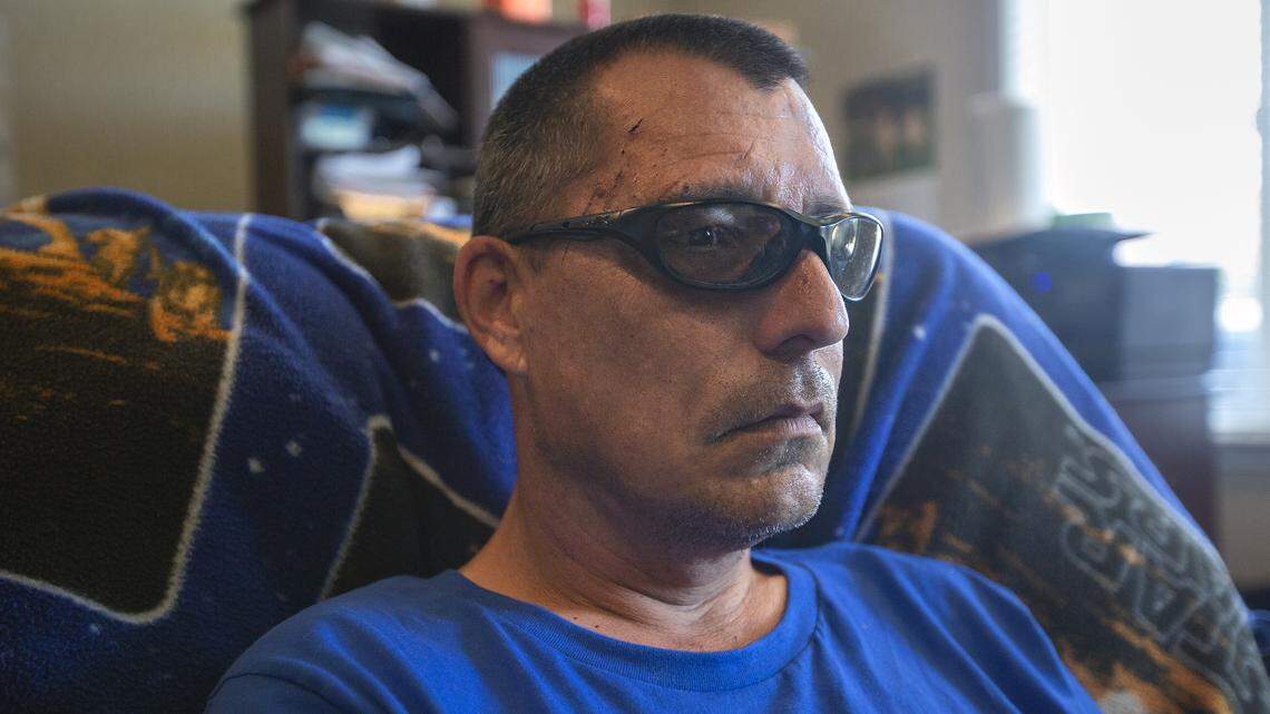 Bill Evans has been unable to work since he suddenly began having seizures after 12 years at the Hanford nuclear reservation. Cuts he suffered during one of his recent seizures continue to heal.