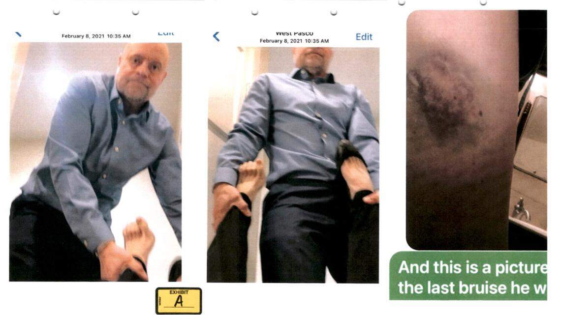 The former wife of Benton Franklin Superior Court Judge Sam Swanberg submitted these photos in a court filing claiming he dragged her out of a room against her will in February 2021. She filed the document after his recent girlfriend filed a harassment claim against him.
