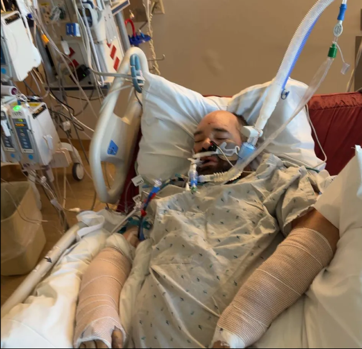 A hit and run crash in Kennewick left motorcycle driver Adam Garrison with two broken arms and other serious injuries. He has been in the intensive care unit of Kadlec Regional Medical Center for six days.