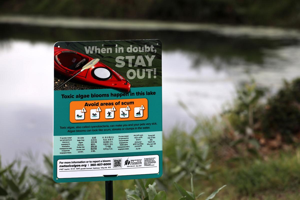 A sign like those posted at the family fishing pond in Columbia Park in Kennewick warns of the potential dangers of toxic algae blooms.