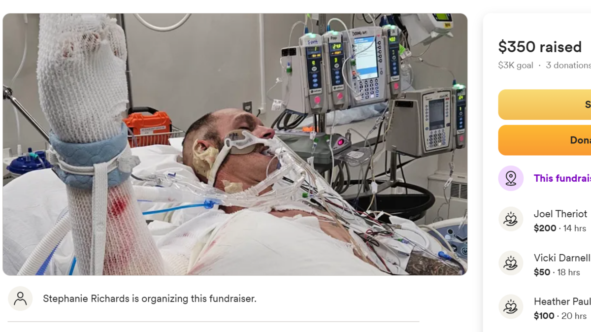 Zach Whittlesey was flown to Seattle Friday with third degree burns over a third of his body after a freak accident.