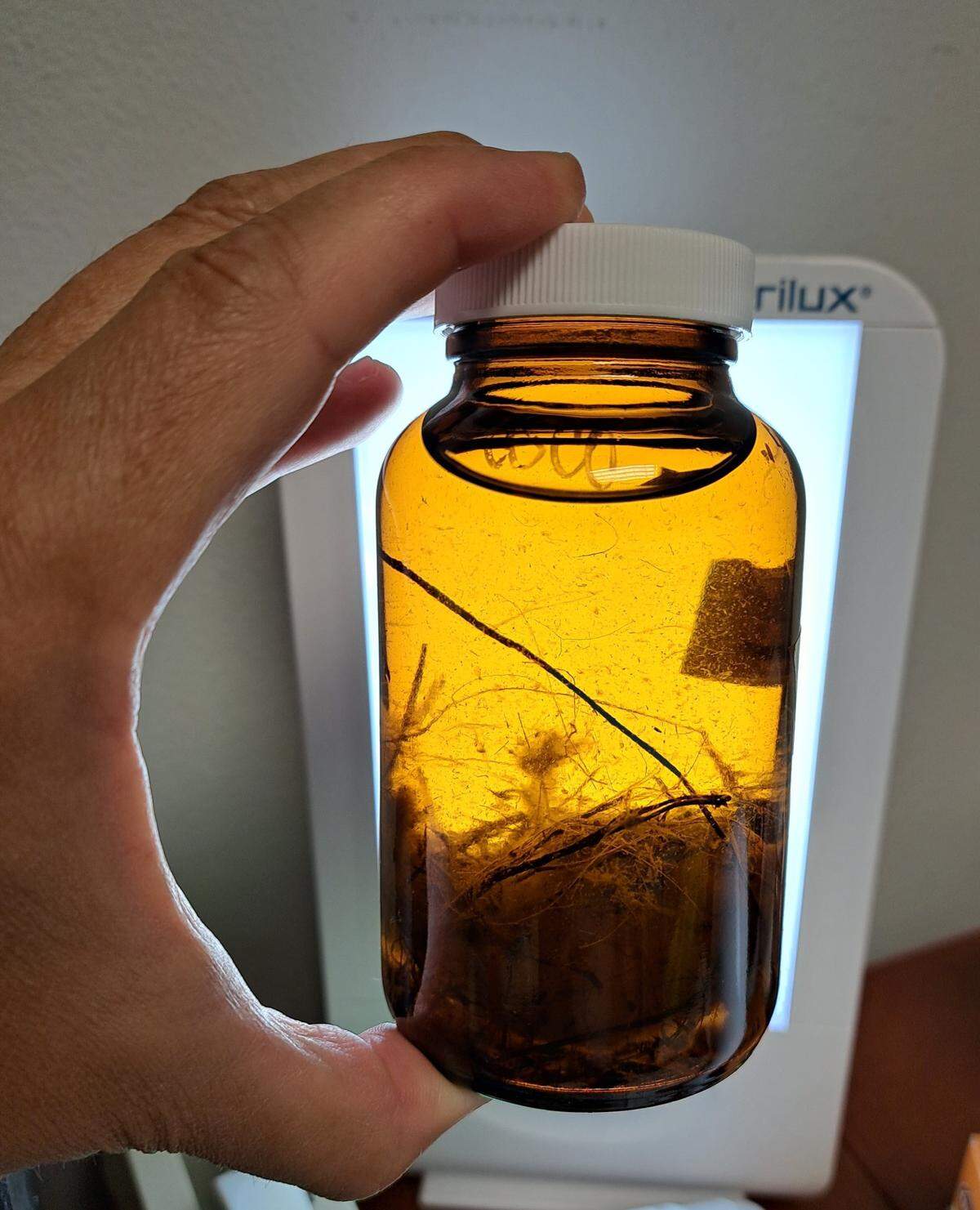 Toxic algae sample