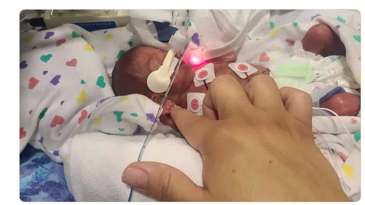 The GoFundMe hoped to raise money to help Ayla’s parents afford to stay in Seattle with her.