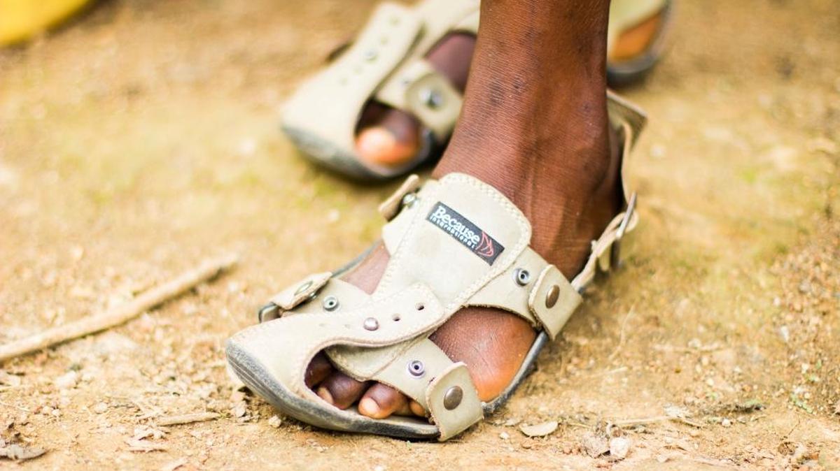 A child in poverty wears a new pair of The Shoe That Grows. The shoes have reached 40 countries around the world.