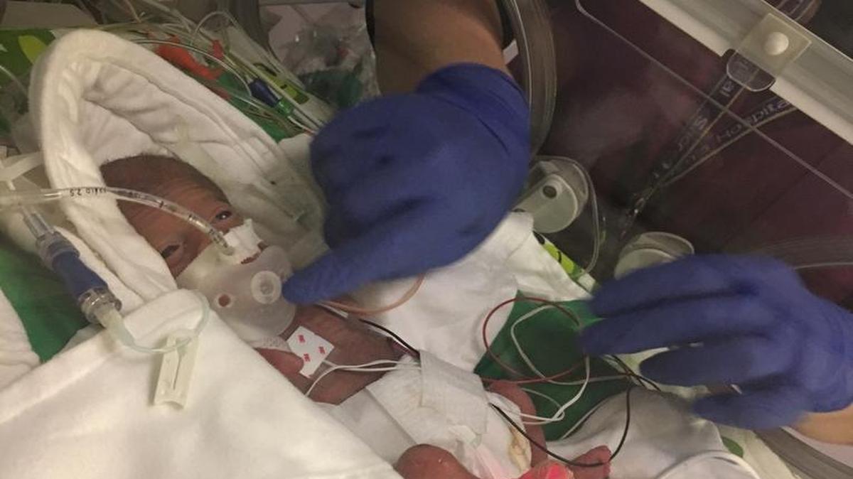 Rayden Mondragon is using a pacifier designed for premature babies