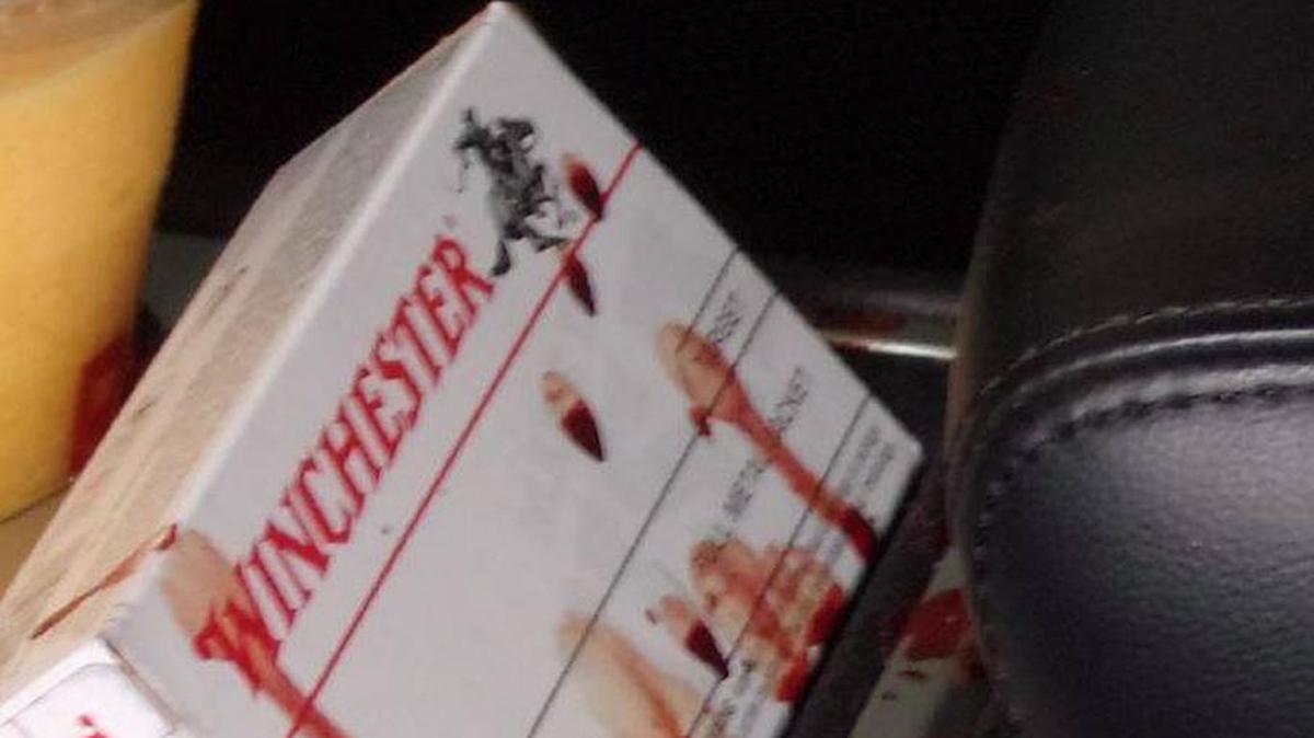 A woman was driving Saturday when her own pistol discharged as her front seat passenger was putting the gun back together. The bullet went into her chest and required emergency surgery. Pasco police are describing it as an “unintentional shooting.”