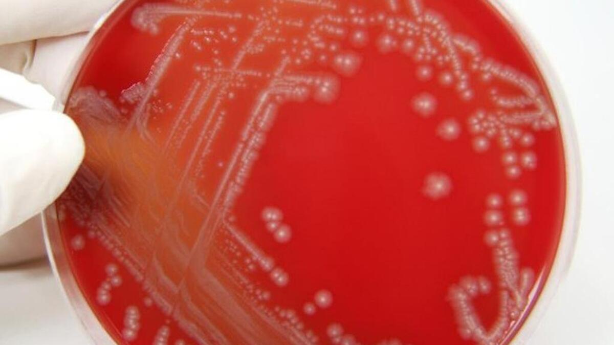 Pride & Joy Creamery in Toppenish recalled raw milk products Wednesday over E. coli concerns.