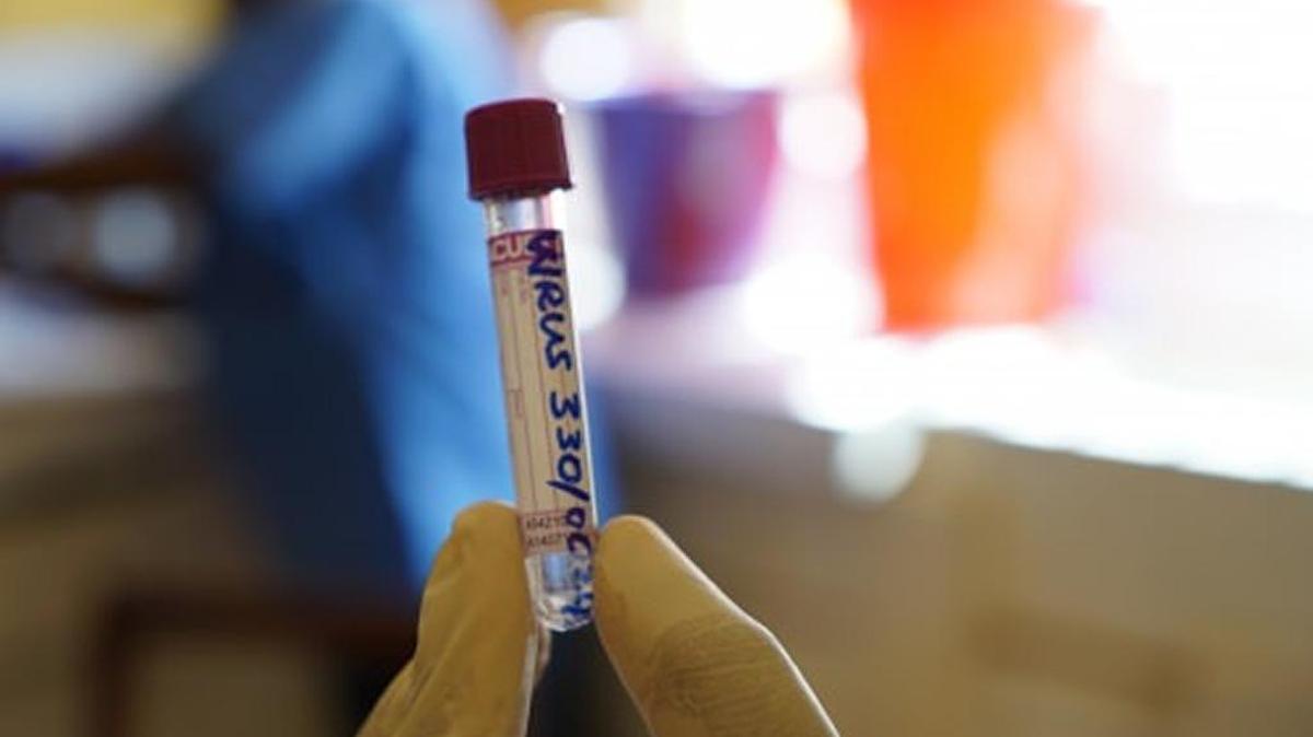 A vial is labeled and prepared to hold blood from an Ebola patient in Sierra Leone.