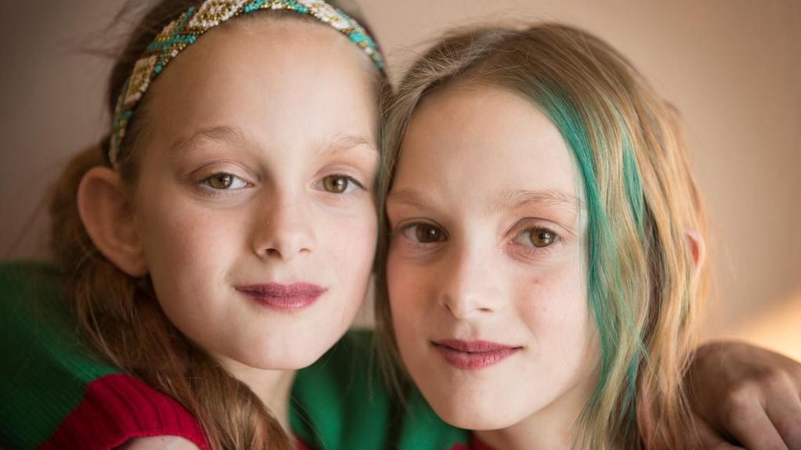 Born conjoined, N.D. girls beat surgical odds and are thriving at 11