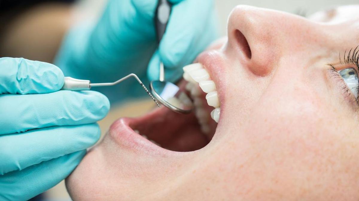 Free dental care will be offered for one Saturday to Tri-Cities area residents without insurance.